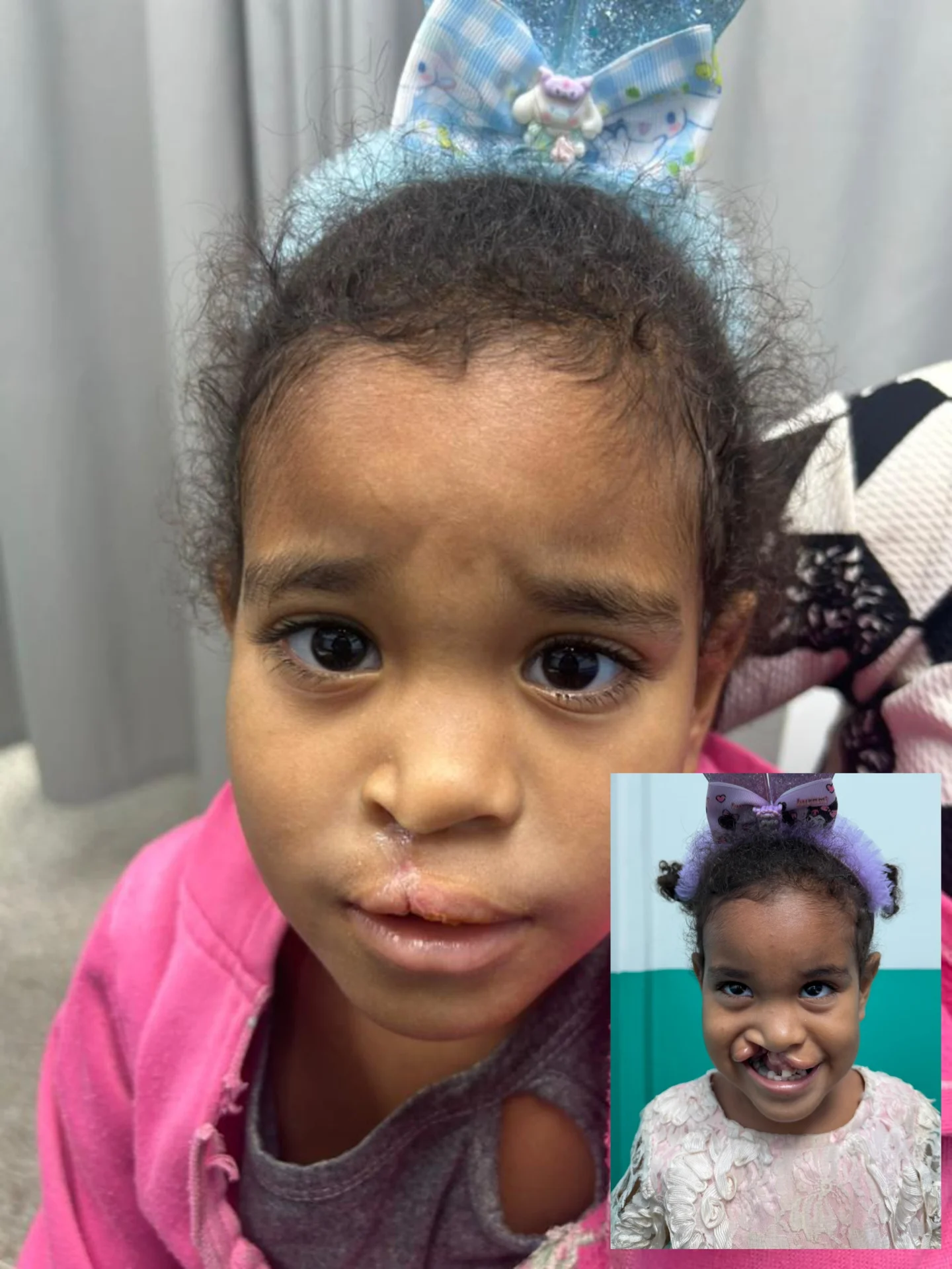 Hoy vivimos una jornada llena de luz y esperanza en la consulta postoperatoria de nuestra 2da Jornad...