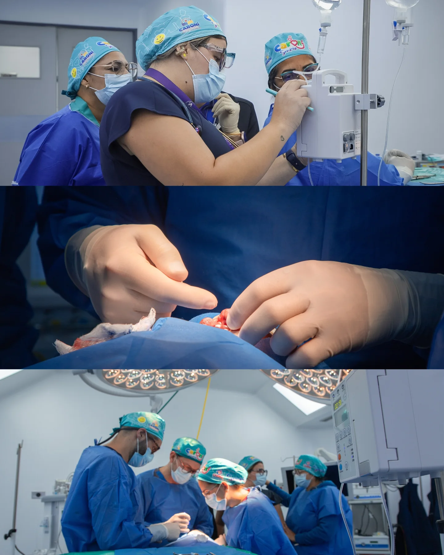 Detrás de cada cirugía en el Plan Caroní Sonríe, hay un equipo de médicos, enfermeras y especia...