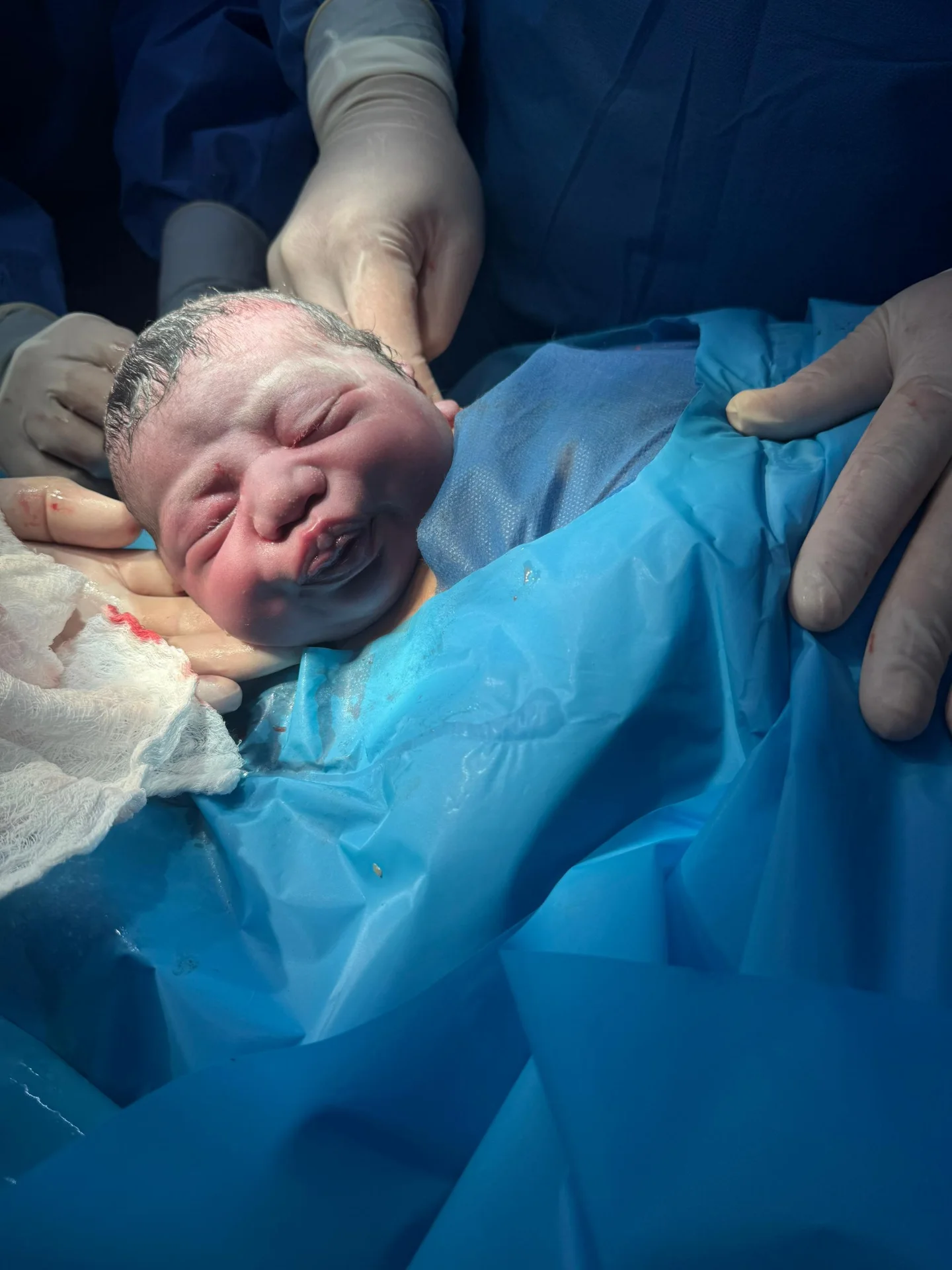 En la Clínica Popular de la Mujer Las Amazonas, celebramos la grandeza de dar vida!

Tres cesáreas...